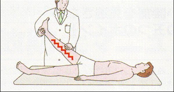 Paresthesia: The pins and needles feeling you get when part of your body falls asleep. Bonus! This is known as obdormition.