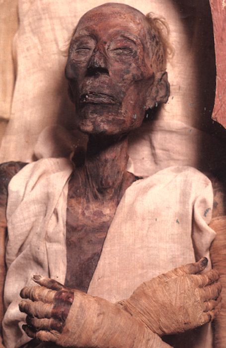The preserved 3226 year old body of Ramses II
