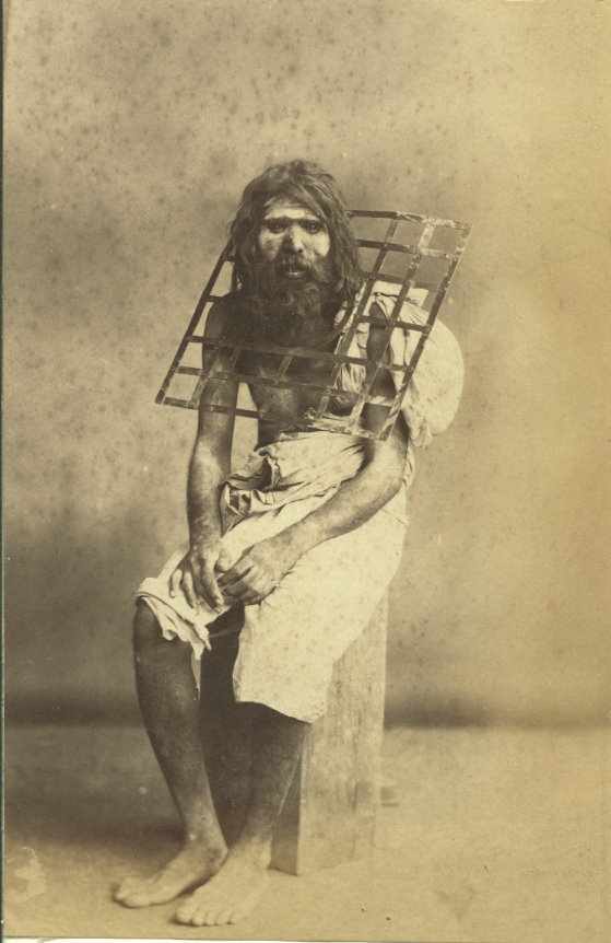 Asceticism is a lifestyle characterized by abstinence from various worldly pleasures. This guy welded a metal grid around his neck so he could never lie down again.