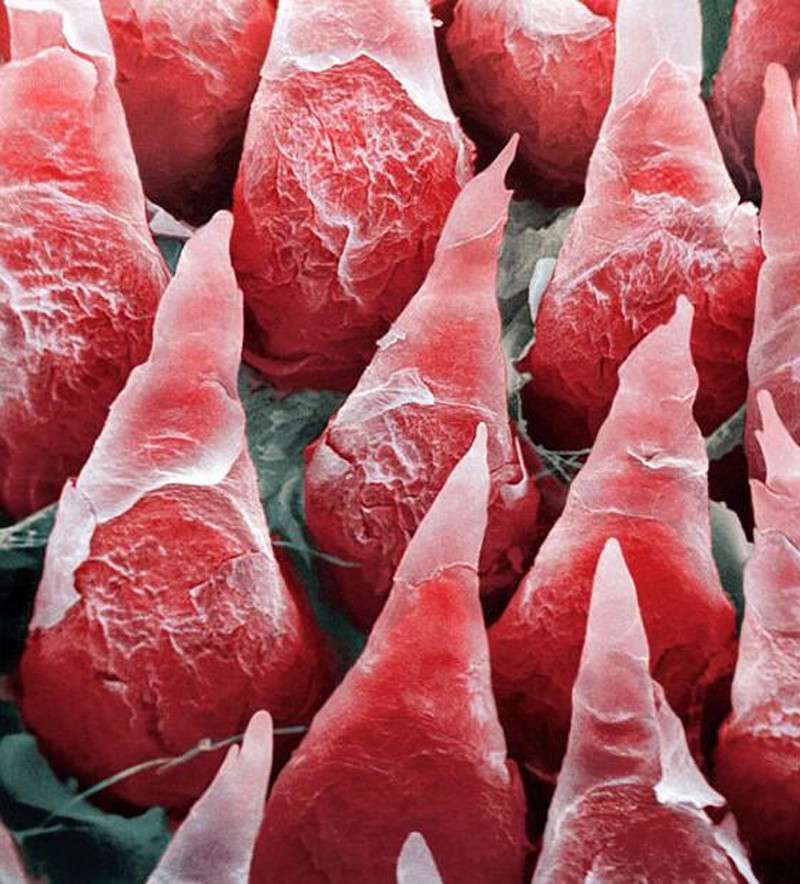 A zoomed in view of the human tongue.