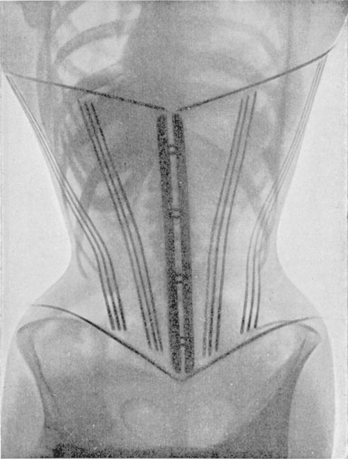 Ribs in a corset