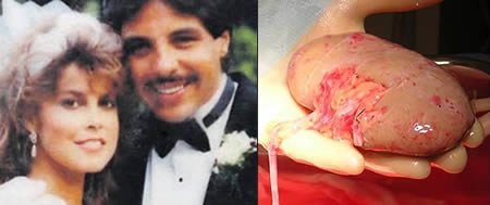 The woman who cheated on her husband after he donated his own kidney to her: Dr Richard Batista married Dawnell Batista in 1990. In 2001, after two previous transplants failed, Batista proved to be a match to his wife, so he duly gave her one of his own kidneys. After recovering from the life-saving transplant, Dawnell repaid Richard's gesture by sleeping with her physical therapist, filing for a divorce, and then denying Richard access to their three kids.