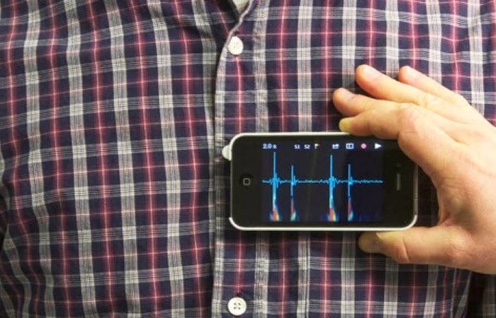 A Stethoscope Phone Case:
Wanna feel unaccomplished? This ingenious device was developed by a 15-year-old AND he got to show it off on The Tonight Show with Jimmy Fallon. It's currently waiting approval in the United States, but expect more medical devices to become mobile.