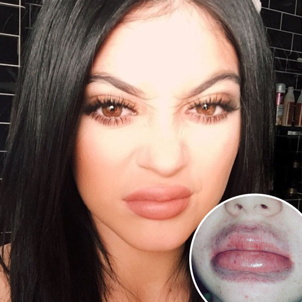 Kylie Jenner lip trend.  Girls are loving the overlined bold lips.