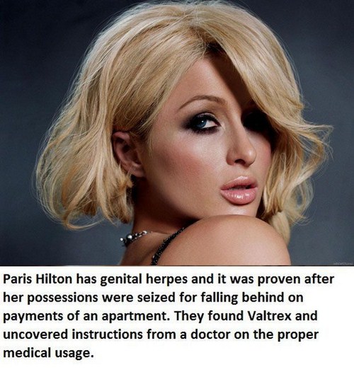 15 Celebrities Who Have STDs