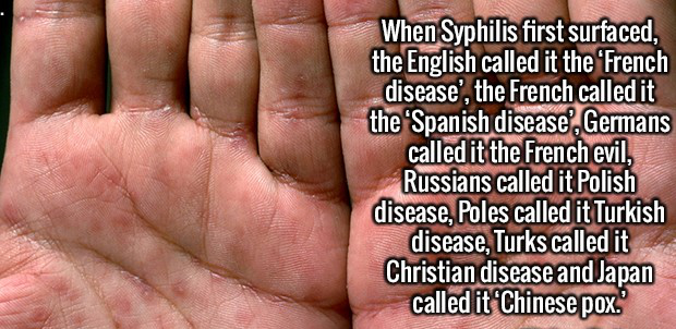 nail - When Syphilis first surfaced, the English called it the French disease', the French called it the Spanish disease, Germans called it the French evil, Russians called it Polish disease, Poles called it Turkish disease, Turks called it Christian dise