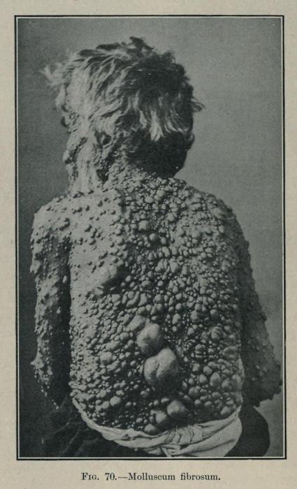 Freaky Medical Pictures circa.1890