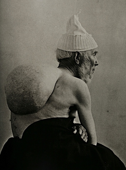 Freaky Medical Pictures circa.1890