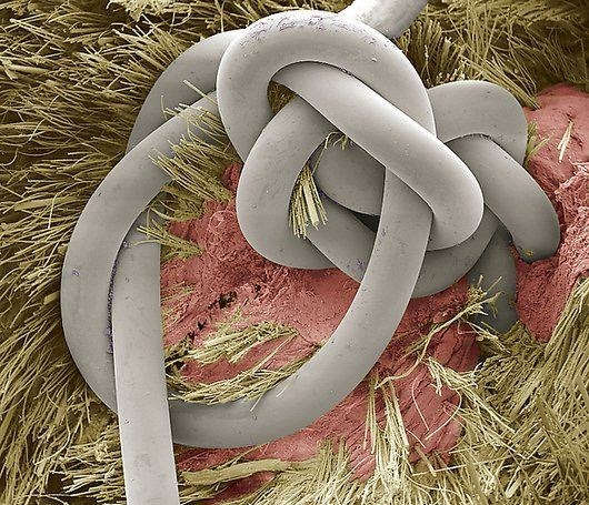 26 Amazing Electron Microscope Images