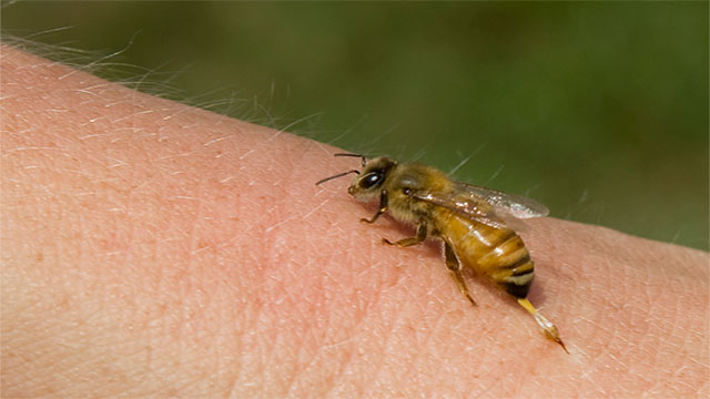 BEE STING-At 1-in-100,000 you are almost twice as likely to die of a bee sting as you are a dog bite