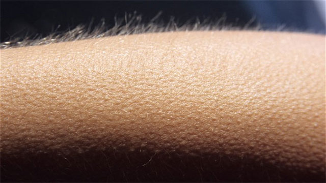 Dead people can get goosebumps