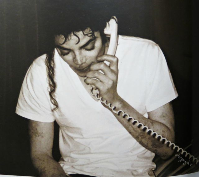 Rare photo of Michael Jackson showing white patches all over his body as a result of vitiligo.