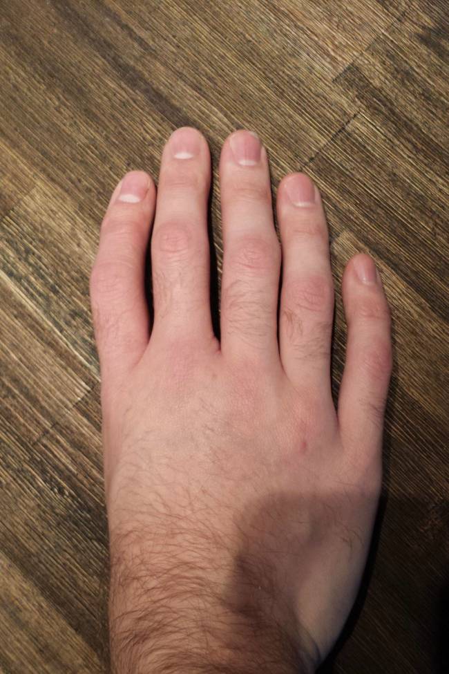 weird hand