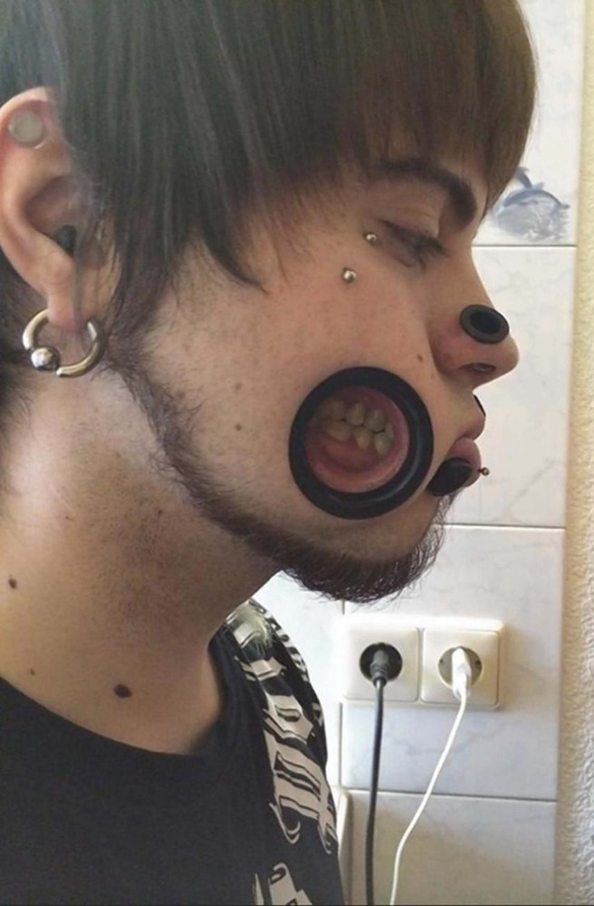 27 Images of Extreme Body Modifications!
