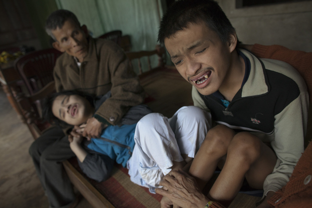 Brothers Nguyen Van Chuoi 26 and Nguyen VanTrong 22 are held by their father as they suffer the effects of Agent Orange more than 30 years after the war in Vietnam