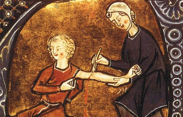 Bloodletting Forced Illness to Drop Out of the Body-Ancient physicians in Greece, Egypt, and other parts of the world believed that drawing blood straight from the veins was a great way to instantly get rid of illness. It was highly recommended, especially for indigestion and acne, but the only real benefit was discovered many centuries later when it appeared to relieve rarely hypertension in certain patients. The strangest, yet most impressive thing about bloodletting, however, seems to be that even though it started being practiced in antiquity, doctors only finally stopped using it in the late nineteenth century.