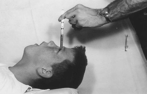 A Lobotomy for Various Mental Illnesses-Of course this totally barbaric, hideous, and unsuccessful medical method couldnt be absent from our list. A lobotomy, which was still practiced just until a few decades ago in many countries, consisted of the cutting or scraping away of most of the connections to and from the prefrontal cortex, the anterior part of the frontal lobes of the brain. This results in the total transformation of the patient into a human plant, and even more disturbing, the procedures developer, Antnio Egas Moniz, won a Nobel Prize for PhysiologyMedicine in 1949 for the discovery of the therapeutic value of leucotomy in certain psychoses.
