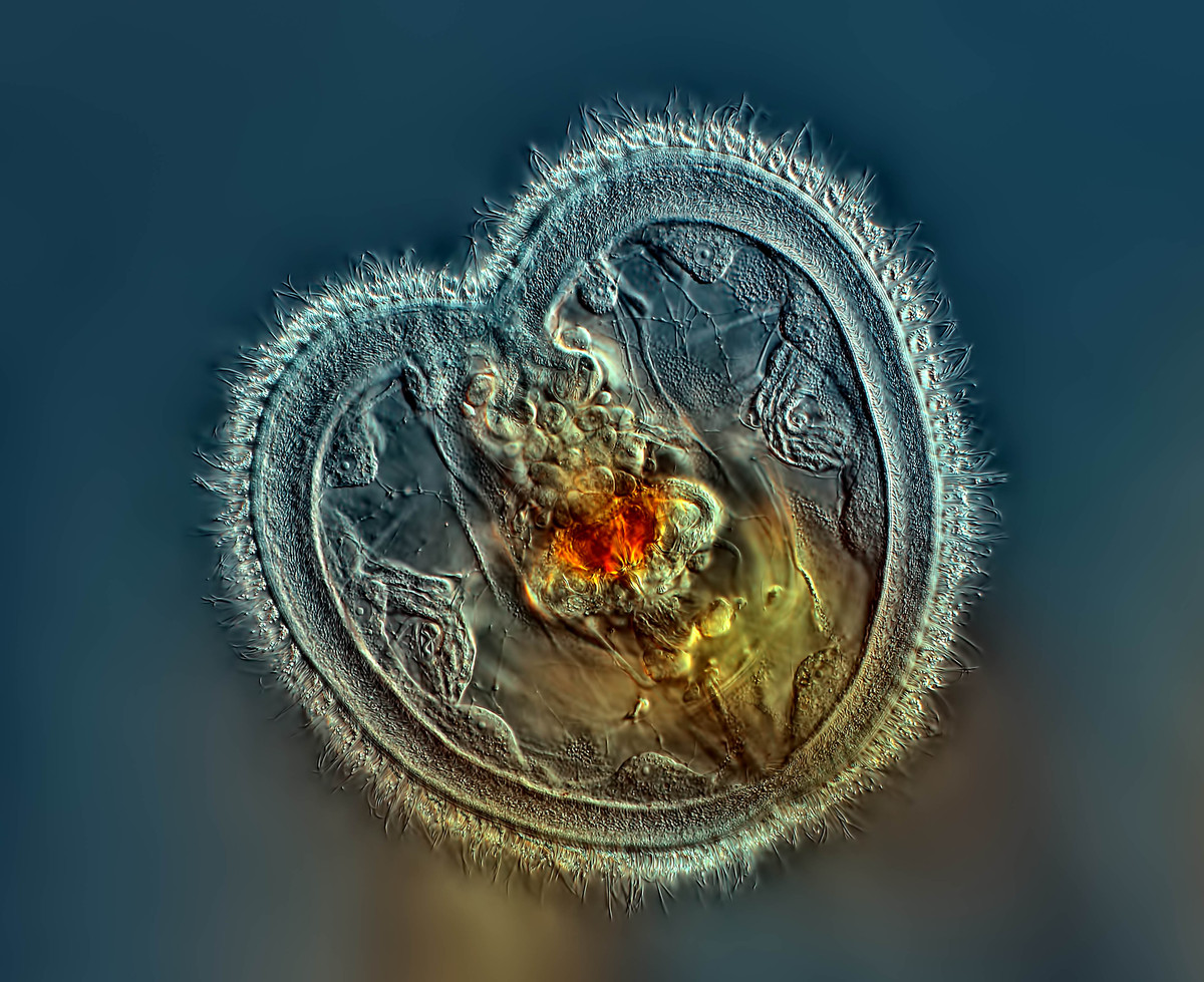. Rotifer showing the mouth interior and heart shaped corona