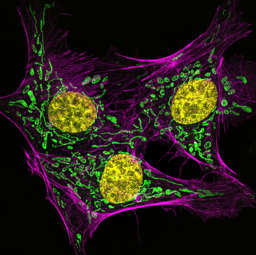 Athens, Georgia, USA. Bovine pulmonary artery endothelial cells stained for actin pink, mitochondria green and DNA yellow.