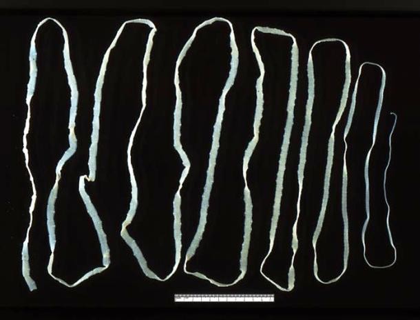 Tapeworm in intestines-Tapeworms are long parasitic creatures frequently found in human intestines where they can live for up to an incredible 25 years. On average, tapeworms found in humans are several meters long with the longest tapeworm ever found inside a human body measuring 25 meters (82 feet) long.