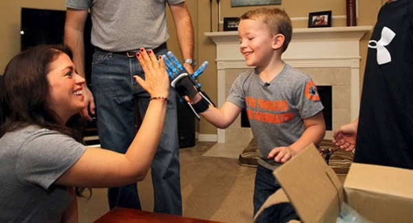 3D Printed Prosthetic Iron Man Hand-
Keith Harris was born with a deformed right hand caused by a rare condition called symbrachydactyly. Mother Kim Harris said her son has come out of his shell with the new hand.

Keith got his 3D hand through a group called the E-Nable Organization. A volunteer in North Carolina created the hand, which cost only $45. A new prosthetic would have been too expensive, about $40,000, and would have lasted only as long as Keith didn't grow
