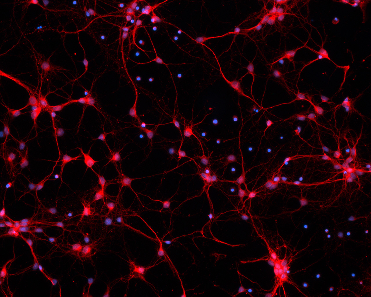 Photos Of Neurons In The Brain