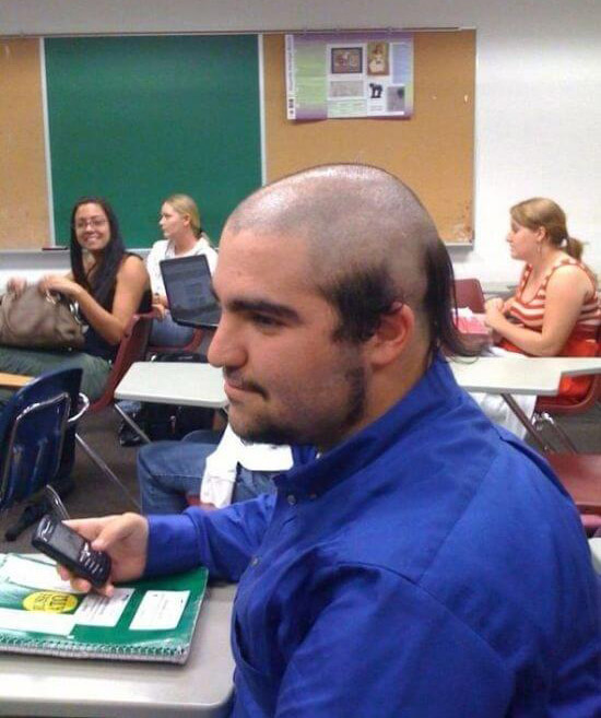 worst bald hairstyle