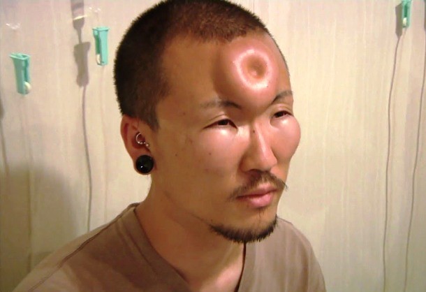 Bagel head...Pioneered in Canada and now practiced mainly in Japan, bagel head is a body modification in which a saline is injected into a person´s forehead, creating a temporary swelling distortion of the head that resembles a bagel or a doughnut (hence the name).