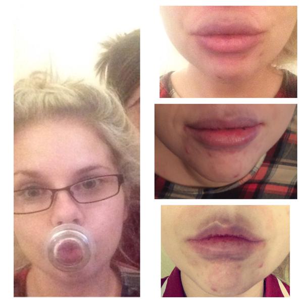 22 Teens Who Tried (And Failed) The #KylieJennerChallenge