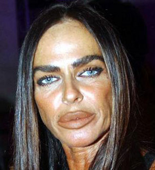 22 Plastic Surgeries Gone Way Wrong