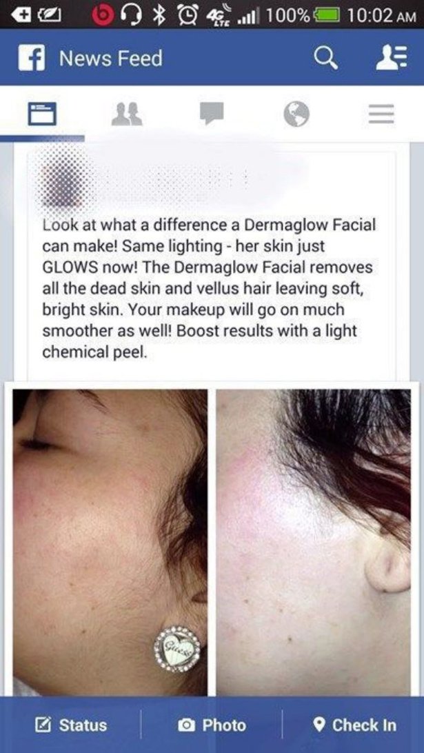 facebook false advertising - o Onx @ f News Feed 100% Q Look at what a difference a Dermaglow Facial can make! Same lighting her skin just Glows now! The Dermaglow Facial removes all the dead skin and vellus hair leaving soft, bright skin. Your makeup wil
