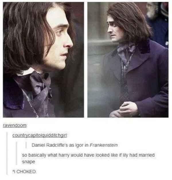 tumblr - daniel radcliffe igor - ravendoom countrycapitolquidditchgiri Daniel Radcliffe's as Igor in Frankenstein so basically what harry would have looked if lily had married snape 4 Choked