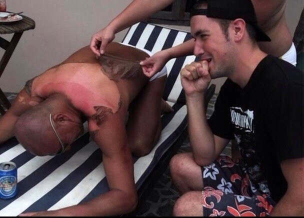 37 Times People Forgot The Sun Was Hot