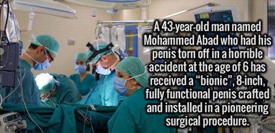 surgeon - A 43yearold man named Mohammed Abad who had his penis torn off in a horrible accident at the age of 6 has received a bionic, 8inch, fully functional penis crafted and installed in a pioneering surgical procedure.