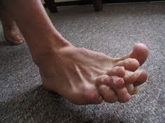 25 Most Bizarre Hands and Feet Ever!