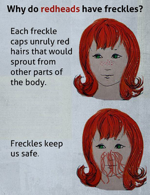 do gingers have freckles - Why do redheads have freckles? Each freckle caps unruly red hairs that would sprout from other parts of the body. Freckles keep us safe.