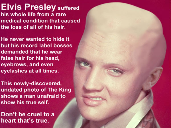 elvis facts - Elvis Presley suffered his whole life from a rare medical condition that caused the loss of all of his hair. He never wanted to hide it but his record label bosses demanded that he wear false hair for his head, eyebrows, and even eyelashes a