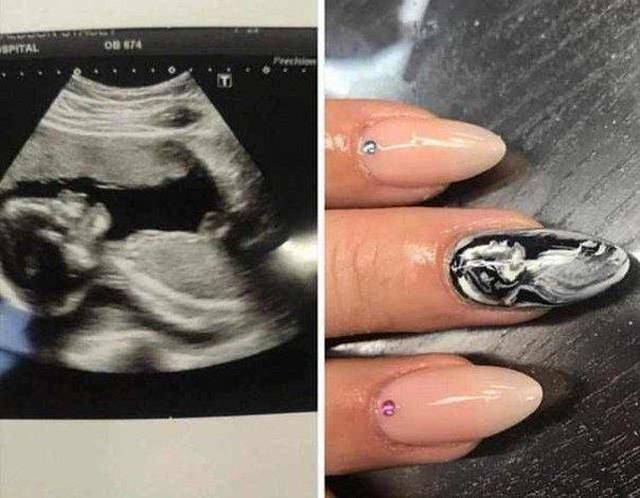 baby scan nails