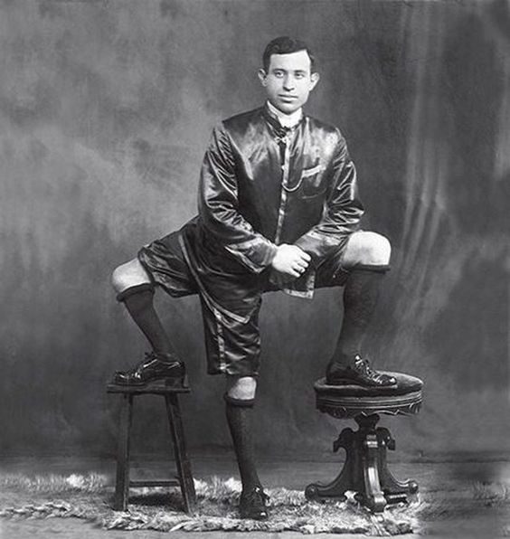 Frank Lentini, known as "The Three-Legged Man" didn't just have three legs, but four feet, sixteen toes, and two functioning sets of genitals.
