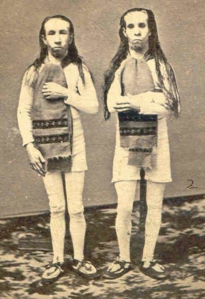 These "Wild Men of Borneo" were actually developmentally disabled under-grown twins sold by their mother to the circus.