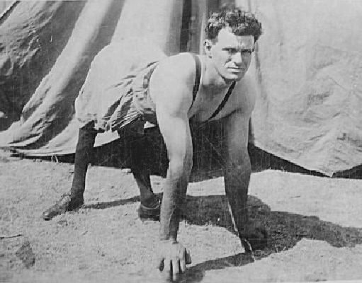 This man, known as Robert "The Pony Boy" Huddleston, suffered from inverted knee joints that kept him from standing up straight.