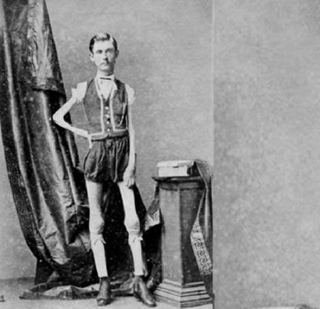 This man, Isaac Sprague, was presented as "The Living Skeleton."