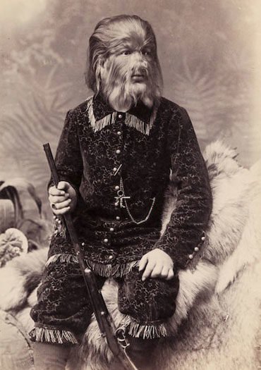 Fedor Jeftichew was a Russian child suffering from hypertrichosis (excessive hair growth) and was given the bizarre name "Jo-Jo the Dog-Faced Boy."