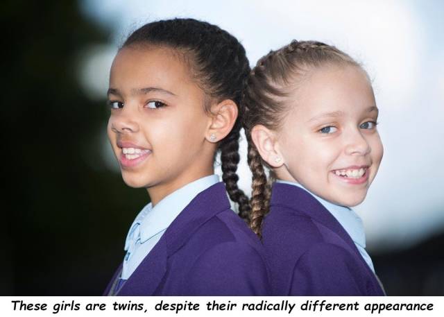 fraternal twins different races - These girls are twins, despite their radically different appearance