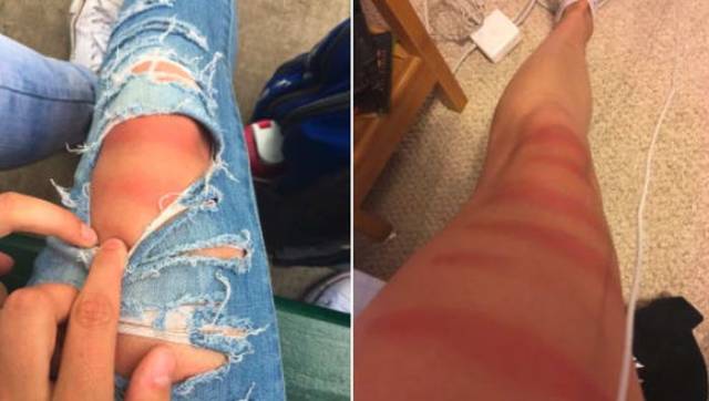 16 Girls Who Got Hilarious Sun Burns Through Their Ripped Jeans 
