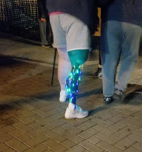 christmas tree leg prosthetic lights christmas