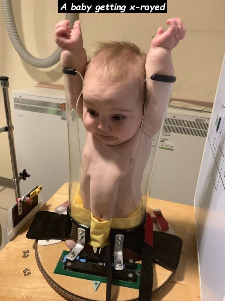 funny pics - A baby getting X-rayed