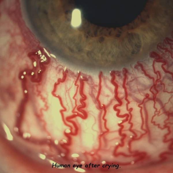 zoomed in eye when high - Human eye after crying.