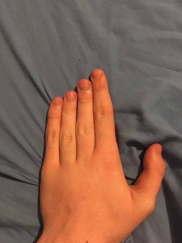 weird fingers