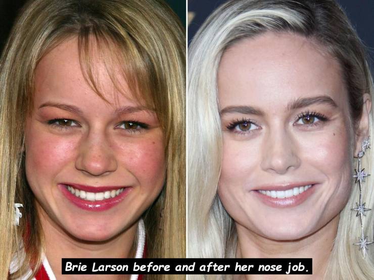 brie larson nose job - Brie Larson before and after her nose job.